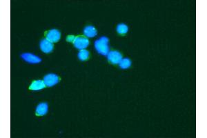 Image no. 2 for anti-Neural Cell Adhesion Molecule 1 (NCAM1) antibody (ABIN335373) (CD56 antibody)