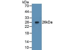 Detection of Recombinant PTX3, Rat using Monoclonal Antibody to Pentraxin 3, Long (PTX3) (PTX3 antibody  (AA 195-381))