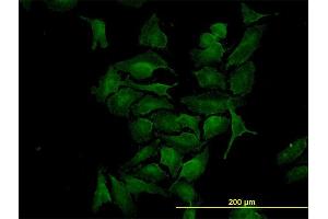 Immunofluorescence of monoclonal antibody to CDK4 on HeLa cell. (CDK4 antibody  (AA 211-303))