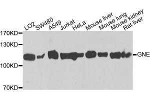 Western blot analysis of extracts of various cell lines, using GNE antibody. (GNE antibody)