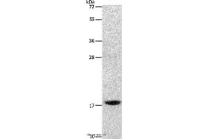 Western blot analysis of Mouse stomach tissue, using GRP Polyclonal Antibody at dilution of 1:1000 (Gastrin-Releasing Peptide antibody)