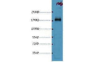 Western Blotting (WB) image for anti-Epidermal Growth Factor Receptor (EGFR) antibody (ABIN3178597) (EGFR antibody)