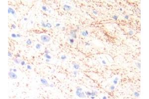 Detection of IL13 in Human Brain Tissue using Polyclonal Antibody to Interleukin 13 (IL13) (IL-13 antibody  (AA 25-146))