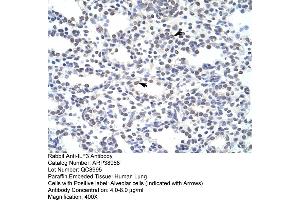 Human Lung (Interleukin enhancer-binding factor 3 (ILF3) (N-Term) antibody)