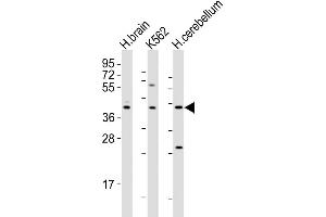 Western Blot at 1:2000 dilution Lane 1: human brain lysates Lane 2: K562 whole cell lysates Lane 3: human cerebellum lysates Lysates/proteins at 20 ug per lane.