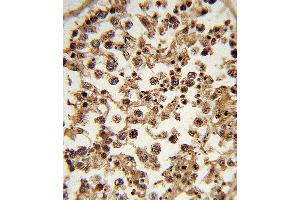 Formalin-fixed and paraffin-embedded human testis tissue reacted with ETV6 Antibody (N-term), which was peroxidase-conjugated to the secondary antibody, followed by DAB staining. (ETV6 antibody  (N-Term))