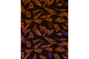 ZC3H7A antibody  (AA 1-220)