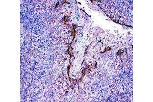 IHC-P: Profilin 2 antibody testing of human tonsil tissue (PFN2 antibody  (C-Term))