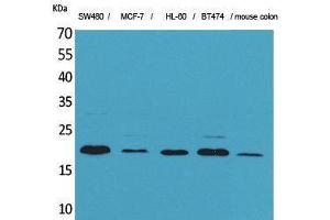 FGF20 antibody  (Internal Region)