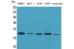 Western Blotting (WB) image for anti-Fibroblast Growth Factor 20 (FGF20) (Internal Region) antibody (ABIN3178209) (FGF20 antibody  (Internal Region))