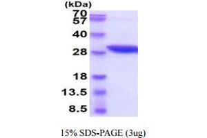 SDS-PAGE (SDS) image for Nicotinamide N-Methyltransferase (NNMT) (AA 1-264) protein (His tag) (ABIN5778253) (NNMT Protein (AA 1-264) (His tag))