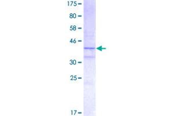 H2AFX Protein (AA 1-143) (GST tag)