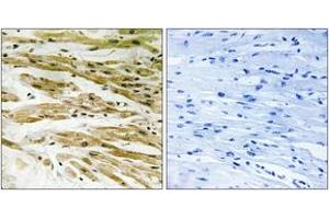 Immunohistochemistry analysis of paraffin-embedded human heart tissue, using DMC1 Antibody. (DMC1 antibody  (AA 61-110))