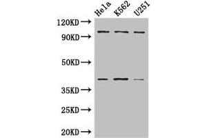 Western Blot Positive WB detected in: Hela whole cell lysate, K562 whole cell lysate, U251 whole cell lysate All lanes: PSMD2 antibody at 3 μg/mL Secondary Goat polyclonal to rabbit IgG at 1/50000 dilution Predicted band size: 101, 83, 86 kDa Observed band size: 101, 40 kDa (PSMD2 antibody  (Regulatory Subunit 2))