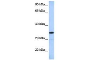 Image no. 1 for anti-BTB (POZ) Domain-Containing Protein KCTD4 (KCTD4) (AA 144-193) antibody (ABIN6742587) (KCTD4 antibody  (AA 144-193))