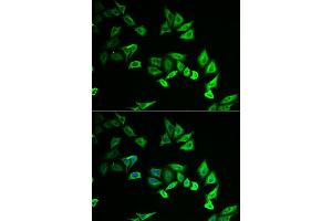 Immunofluorescence analysis of U2OS cell using MYOZ2 antibody. (MYOZ2 antibody)