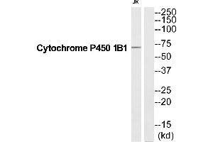 Western blot analysis of extracts from Jurkat cells, using CP1B1 antibody.
