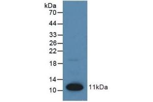 Detection of Recombinant S100, Human using Polyclonal Antibody to S100 Calcium Binding Protein (S100) (S100 Protein (S100) (AA 1-94) antibody)