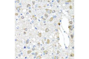 Immunohistochemistry of paraffin-embedded rat brain using BAG5 antibody at dilution of 1:100 (x40 lens). (BAG5 antibody)