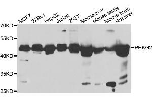 Western blot analysis of extracts of various cell lines, using PHKG2 antibody (ABIN5975111) at 1/1000 dilution. (PHKG2 antibody)