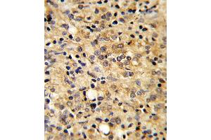 Immunohistochemistry (Paraffin-embedded Sections) (IHC (p)) image for anti-Cartilage Oligomeric Matrix Protein (COMP) (AA 314-343) antibody (ABIN390893)