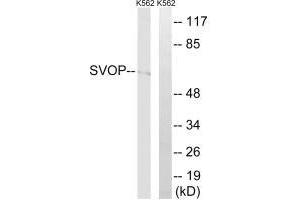Western blot analysis of extracts from K562 cells, using SVOP antibody. (SVOP antibody)