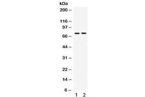 Western blot testing of 1) rat thymus and 2) human placenta lysate with Transferrin antibody.