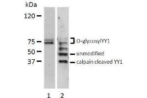 Western blot analysis of total cell lysate (200 µg) from serum stimulated bovine endothelial cells (lane 1) and HeLa cells (lane 2) probed with chicken anti-human YY1 antibody. (YY1 antibody  (full length))