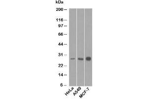 Western blot testing of human samples with Bcl-2 antibody (8C8). (Bcl-2 antibody  (AA 41-54))