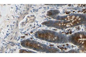 ABIN6274427 at 1/100 staining Mouse intestine tissue by IHC-P. (CAMKV antibody  (Internal Region))