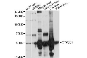 Western blot analysis of extracts of various cell lines, using CYP2E1 Antibody (ABIN5971187) at 1/1000 dilution. (CYP2E1 antibody)