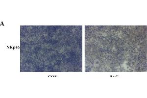 P. (Ly6g antibody)