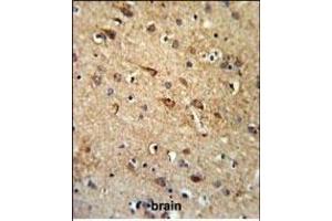RGR Antibody (Center) (ABIN653851 and ABIN2843113) IHC analysis in formalin fixed and paraffin embedded brain tissue followed by peroxidase conjugation of the secondary antibody and DAB staining. (RGR antibody  (AA 265-291))