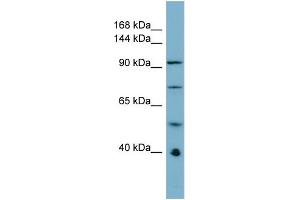 Host:  Rabbit  Target Name:  RBBP6  Sample Type:  ACHN Whole cell lysates  Antibody Dilution:  1. (RBBP6 antibody  (N-Term))