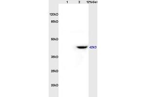 Lane 1: rat brain lysates Lane 2: rat heart lysates probed with Anti CD84/SLAMF5 Polyclonal Antibody, Unconjugated (ABIN741465) at 1:200 in 4 °C. (CD84 antibody  (AA 231-329))