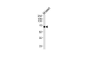 Western blot analysis of lysate from mouse heart tissue lysate, using Mouse Mapkapk3 Antibody at 1:1000 at each lane. (MAPKAP Kinase 3 antibody  (N-Term))