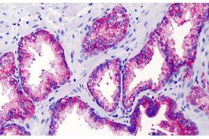 Human Prostate: Formalin-Fixed, Paraffin-Embedded (FFPE) (IKBKG antibody)
