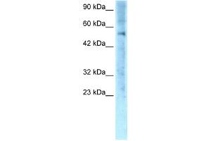 WB Suggested Anti-ZNF500 Antibody Titration: 0. (ZNF500 antibody  (Middle Region))