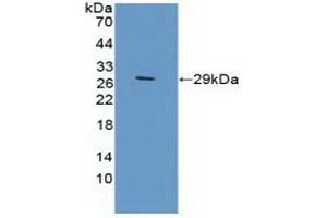 Detection of Recombinant TFR2, Mouse using Polyclonal Antibody to Transferrin Receptor 2 (TFR2) (Transferrin Receptor 2 antibody  (AA 86-259))