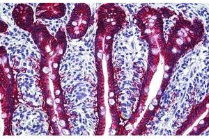 Human Intestine: Formalin-Fixed, Paraffin-Embedded (FFPE) (EpCAM antibody)