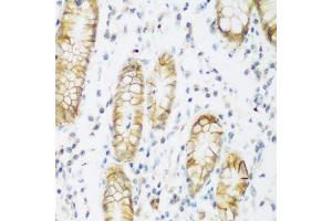 Immunohistochemistry of paraffin-embedded human stomach using KIAA1456 antibody (ABIN5974326) at dilution of 1/200 (40x lens). (KIAA1456 antibody)