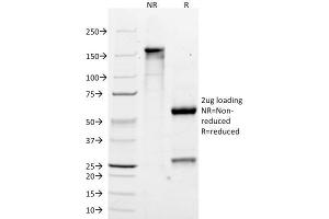 SDS-PAGE Analysis Purified MART-1 Monoclonal Antibody (M2-7C10). (MLANA antibody)