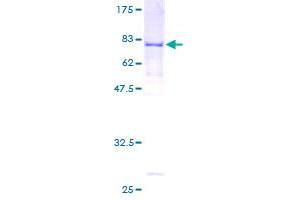 RECQL5 Protein (AA 1-435) (GST tag)