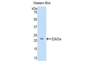 Western Blotting (WB) image for anti-Lanosterol Synthase (2,3-Oxidosqualene-Lanosterol Cyclase) (LSS) (AA 388-549) antibody (ABIN1860102)