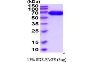 SDS-PAGE (SDS) image for EPH Receptor A4 (EPHA4) (AA 20-547) protein (His tag) (ABIN6387853) (EPH Receptor A4 Protein (EPHA4) (AA 20-547) (His tag))