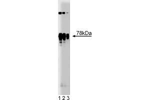 Western Blotting (WB) image for anti-Protein Kinase C, delta (PKCd) (AA 114-289) antibody (ABIN967943) (PKC delta antibody  (AA 114-289))