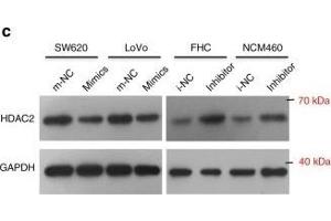 miR-500a-5p suppresses cell proliferation and invasion by targeting HDAC2 in vitro. (HDAC2 antibody  (C-Term))