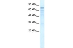 Western Blotting (WB) image for anti-tRNA Methyltransferase 1 (TRMT1) antibody (ABIN2460992) (TRMT1 antibody)
