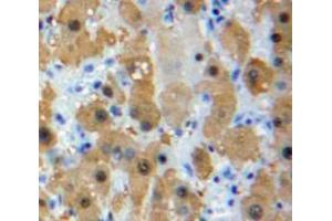 IHC-P analysis of Liver tissue, with DAB staining. (LRP1 antibody  (AA 692-962))