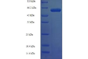 SDS-PAGE (SDS) image for delta-Like 2 Homolog (DLK2) (AA 27-306), (Extracellular) protein (GST tag) (ABIN4974244) (DLK2 Protein (AA 27-306, Extracellular) (GST tag))